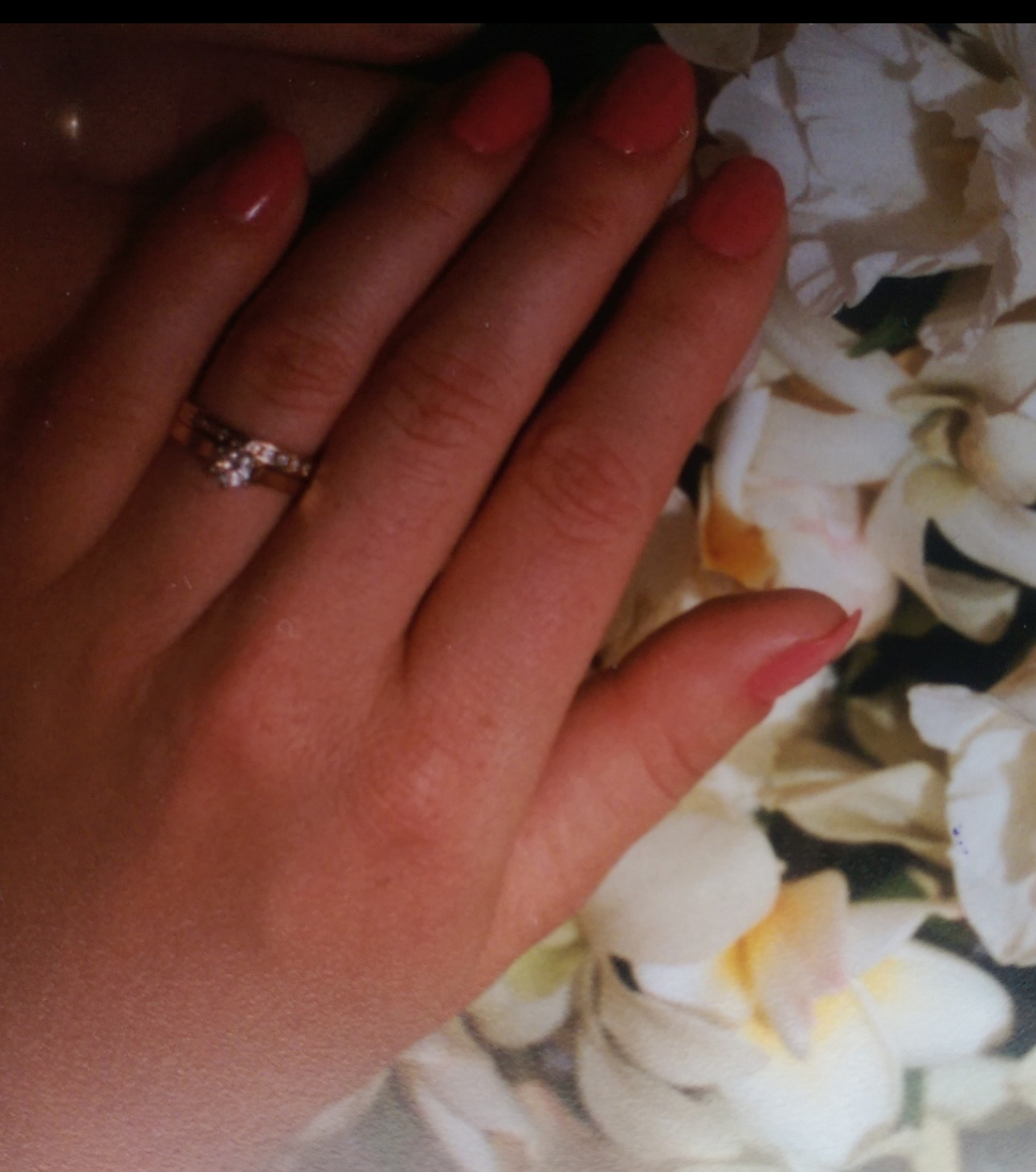 Lost rings